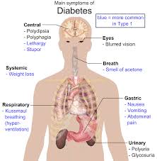 Type 2 Diabetes treatment